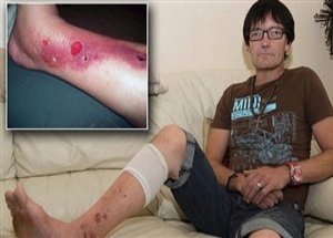 Bu Bitkiye Bastı Dünyası Karardı