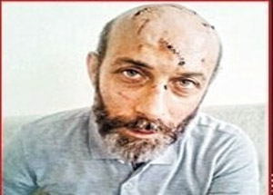 Ünlü Müzisyene Ölümüne Dayak