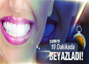 Sadece 10 Dakikada Beyazladı