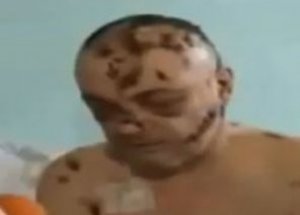 Etleri Çürüyor, Organları Kopuyor