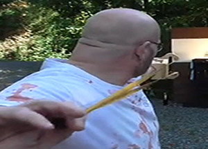 Kendi Sapanıyla Kendini Vurdu!