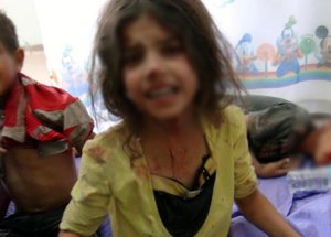 Şam'da Çocuklar Açlıktan Ölüyor