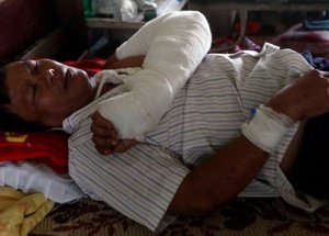 Dünya Bu Vahşete Kör!