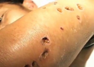 Dev Eşek Arıları Dehşet Saçıyor!