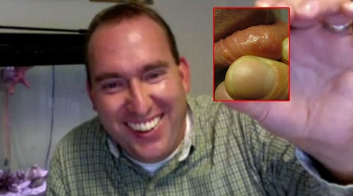 Dudağından kurt çıktı!