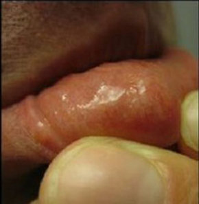 Dudağından Çıkanlar Şok Etti!