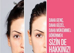 Sadece 8 Haftada Hayal Ettiğiniz Pürüzsüz Cilde Kavuşun