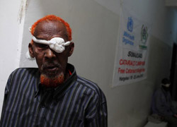 Somali'de 2000 katarakt ameliyatı!