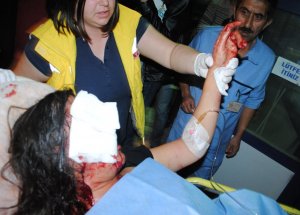 Ablasının Yüzünde Şişe Parçaladı