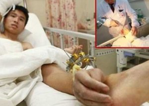 Elini Ayağına Diktiler!