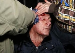 Eski Bakan Bu Hale Geldi