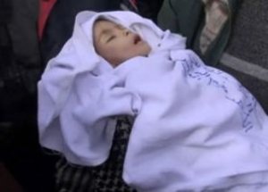 Minik Esra Açlığa Daha Fazla Dayanamadı