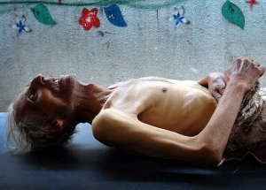 Zalim Rejiminin Son Silahı ''Açlık''