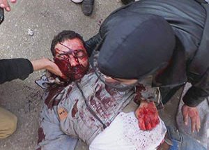 Mısır’da Cunta Katliama Devam Ediyor!