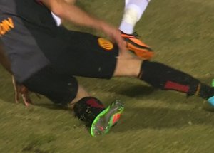 Galatasaraylı Yıldızın Ayağı Kırıldı