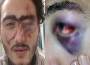 Alman Polisinden Türk Gence Dayak