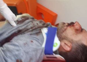 İstanbul'da polise bıçaklı saldırı