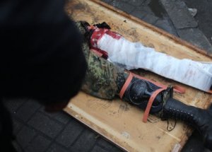 Ukrayna'da Kan Durdu