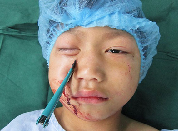 Gözüne Öyle Birşey Saplandı Ki...