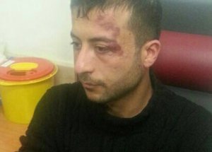 Kılıçdaroğlu'na Yumruk Kararı