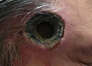 Şakağında Delik Açıldı!