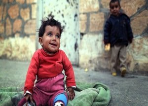 Suriye'de 299 Kişi Açlıktan Öldü