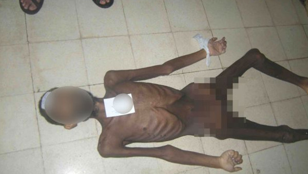 Suriye'deki Vahşetin Fotoğrafları BMGK'da