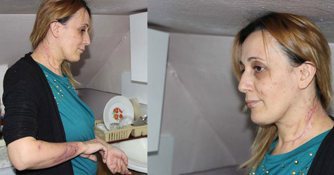 Lavaboyu Açarken Canından Oluyordu