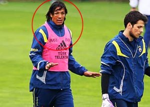 Bruno Alves'in Bu Hali Korkuttu!