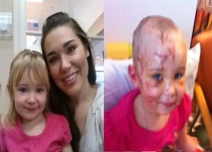 Klişe Gerçek Oldu: İnsan Köpeği Isırdı!