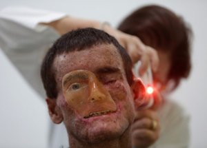 Bu Köyde Yaşayan Herkes Eriyor!