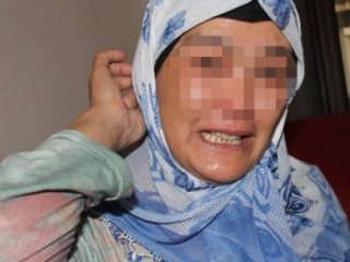 Bu Kadının Vücudundan Bakın Ne Çıkıyor!