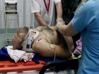 Merdivenden Düşen İşçi Hastanelik Oldu