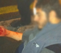 Ankara'nın Göbeğinde Türk Bayrağı Yaktılar