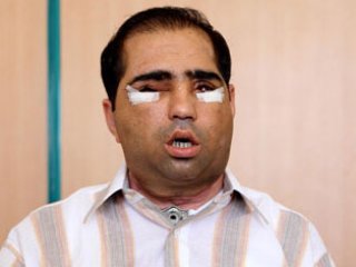 Üslün'ün Yüzü Çıkarıldı!