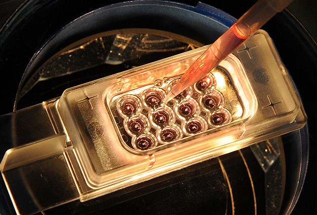 DSÖ Ebola Salgını İçin Toplantı Yapacak