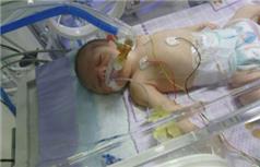 Doğumda İhmal İddiası