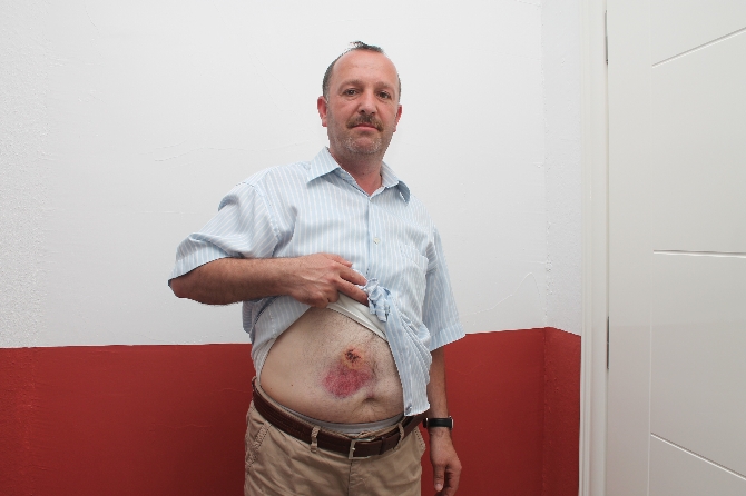 Rol İcabı Vurulacaktı Gerçek Oldu