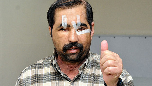 Vefatı Sağlık Bakanlığı'nda Değerlendirilecek