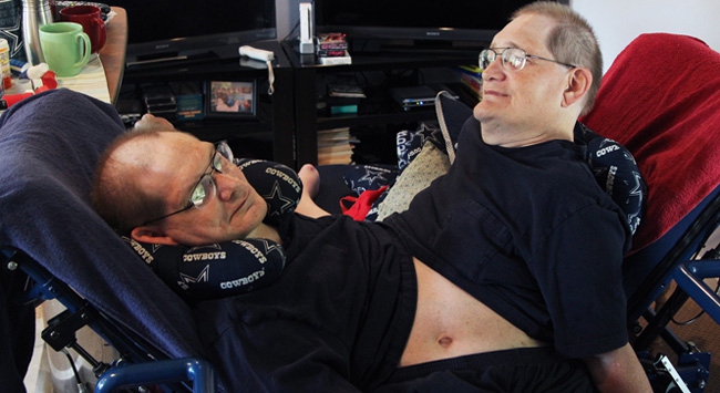 62 Yıldır Aynı Bedeni Paylaşıyorlar