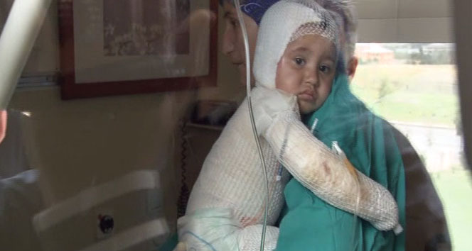 Tandıra düşen çocuk feci şekilde yandı