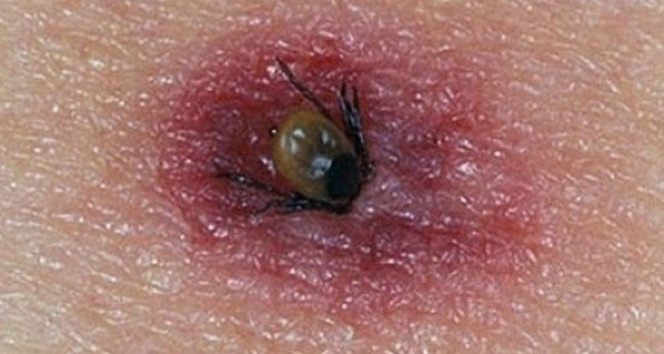 Keneden Bir Ölüm Daha