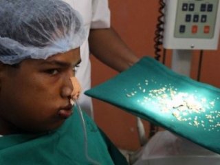 32 Değil, 232 Diş Çıkartıldı!