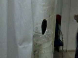 Boğazından Öyle Bir Şey Çıktı Ki..