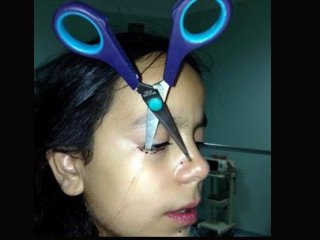 Oyun Oynarken Gözüne Makas Saplandı