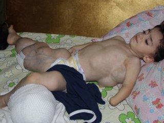 Vücudu Her Geçen Gün Daha Da Şişiyor!