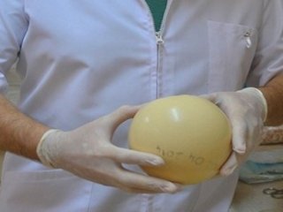 Deve Kuşu Yumurtasından Bakın Ne Yaptılar!