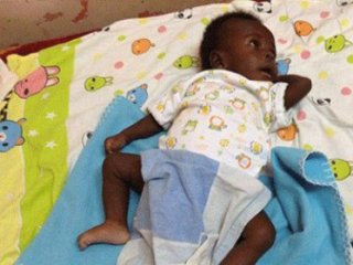 4 Kol Ve 4 Ayaklı Bebek!