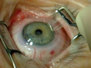 Özel Hastanede Skandal! Kör Oldular