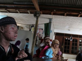 Görenleri Dehşete Düşürüyor!